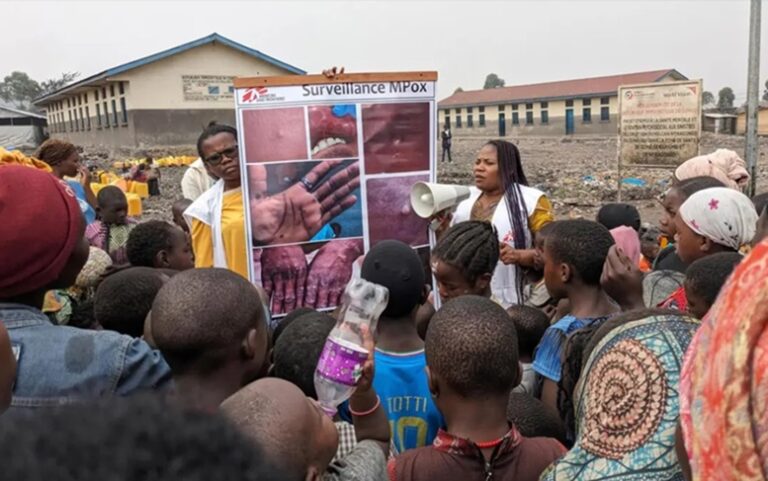 Mpox crisis, a new global health alert and what It means for Africa