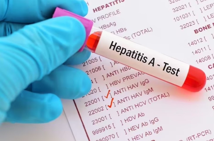 Czech Republic battles escalating Hepatitis A epidemic